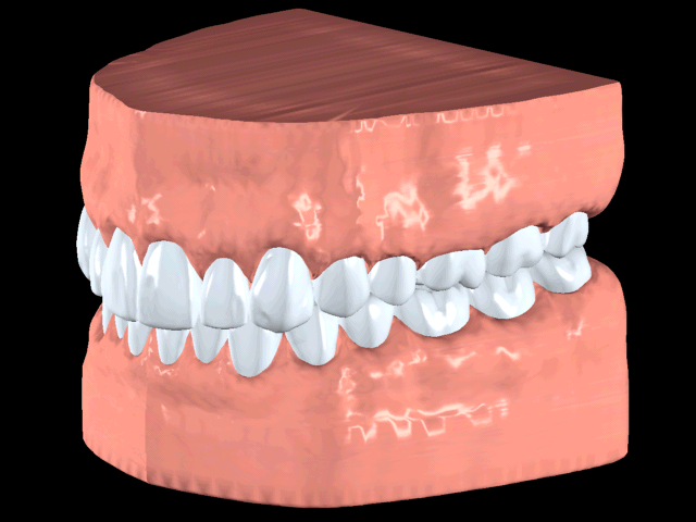 Teeth in one arch are arranged to contact teeth within the other arch.